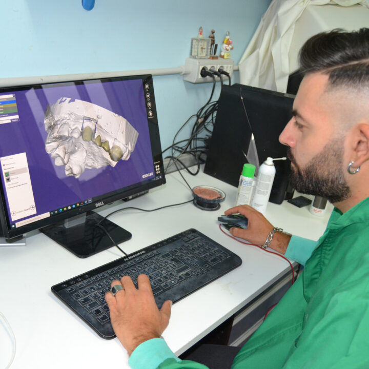 Barre CAMCAD Laboratorio Odontotecnico F.lli Campanella